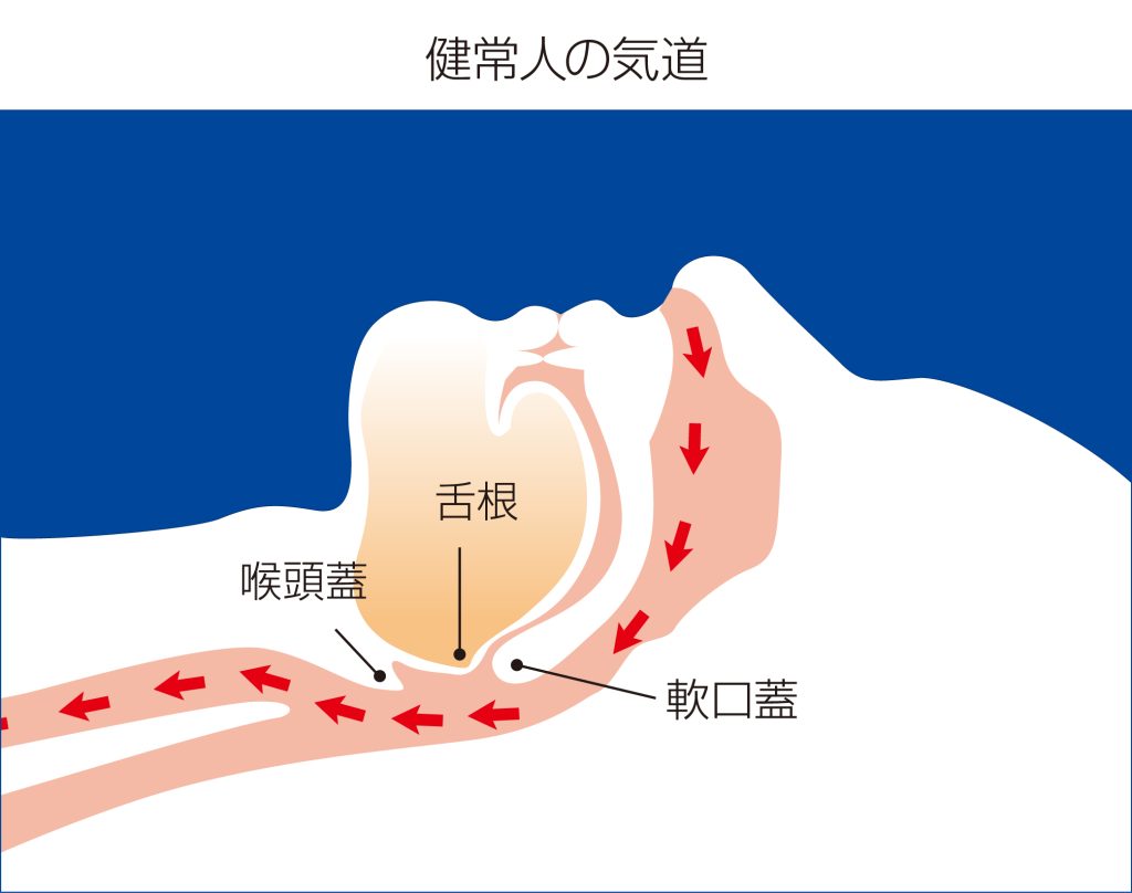 健常人の気道（正常）