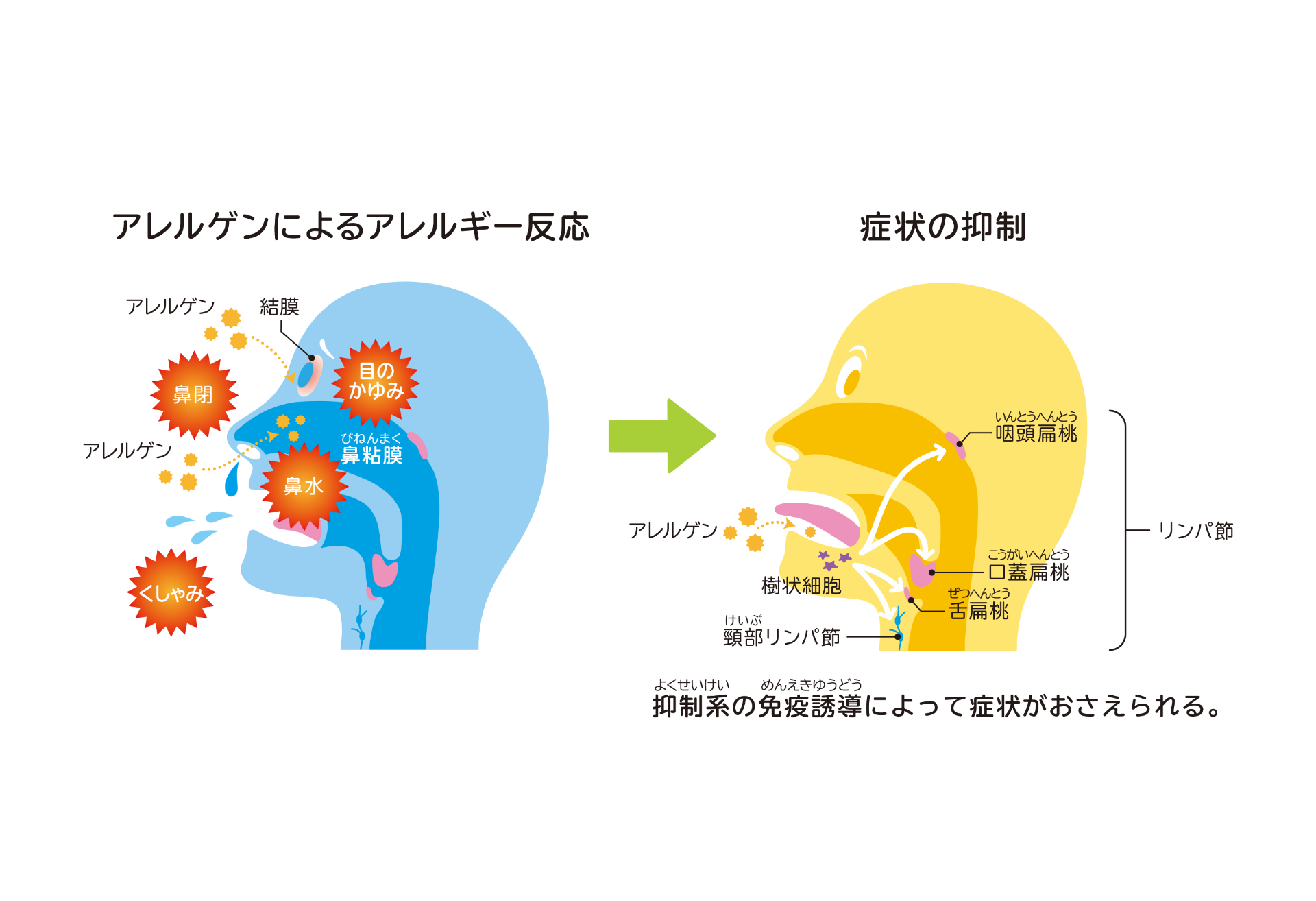 模式図：舌下免疫療法（抑制系の免疫誘導）