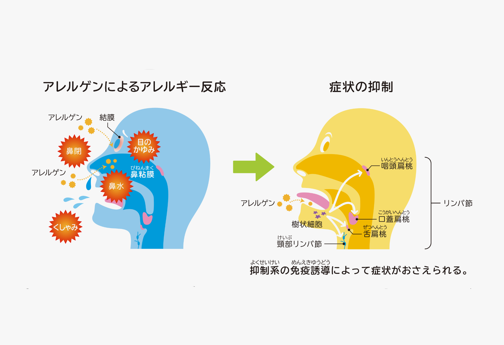 舌下免疫療法